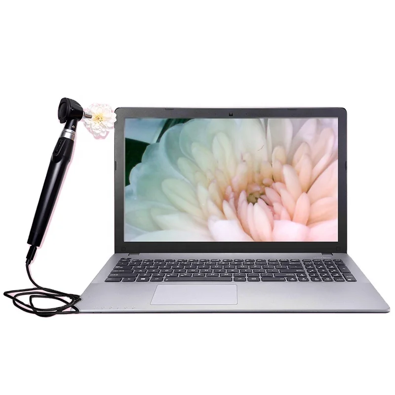 Factory Direct Sell Durable and Portable Digital Video Otoscope with Camera Medical USB Ear Diagnostic camera Equipments