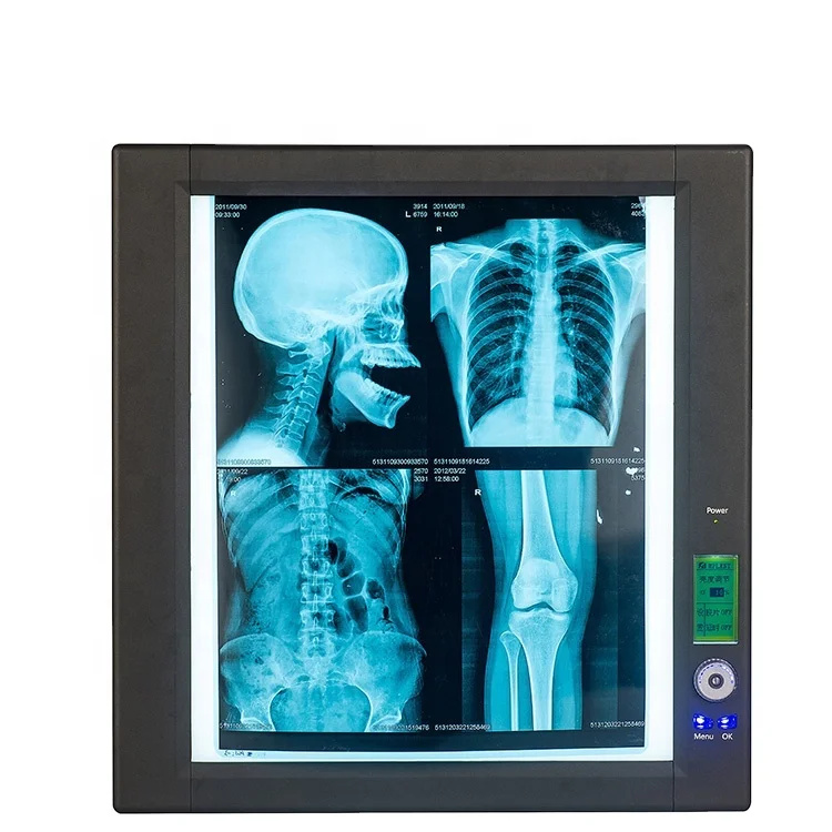 
Medical induction and adjusting light single and two brank X-ray film viewer 