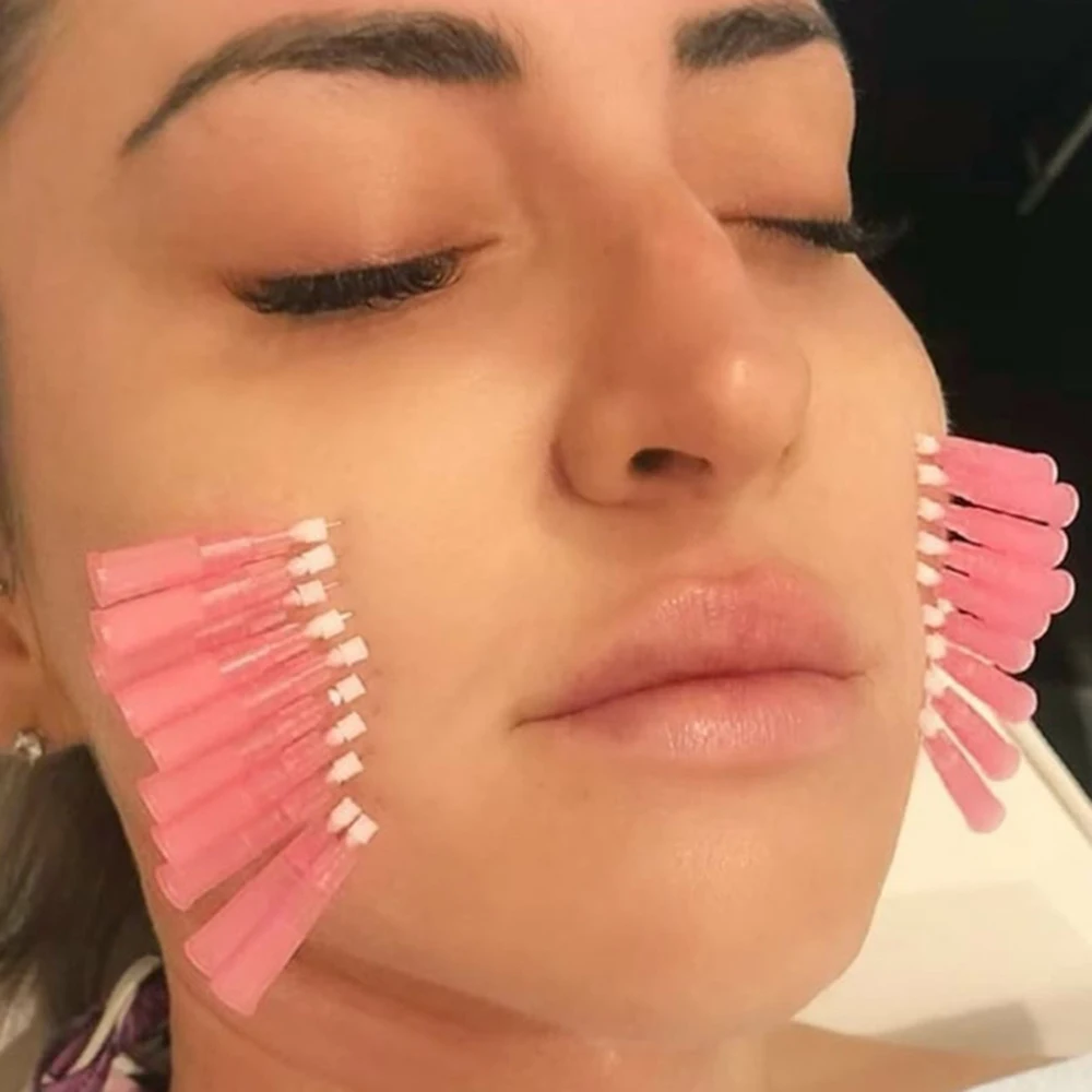 Face Lifting PDO Cog 3D/4D/6D Molding Cog Hilos Tensores PDO PCL PLLA Thread Lift Korea