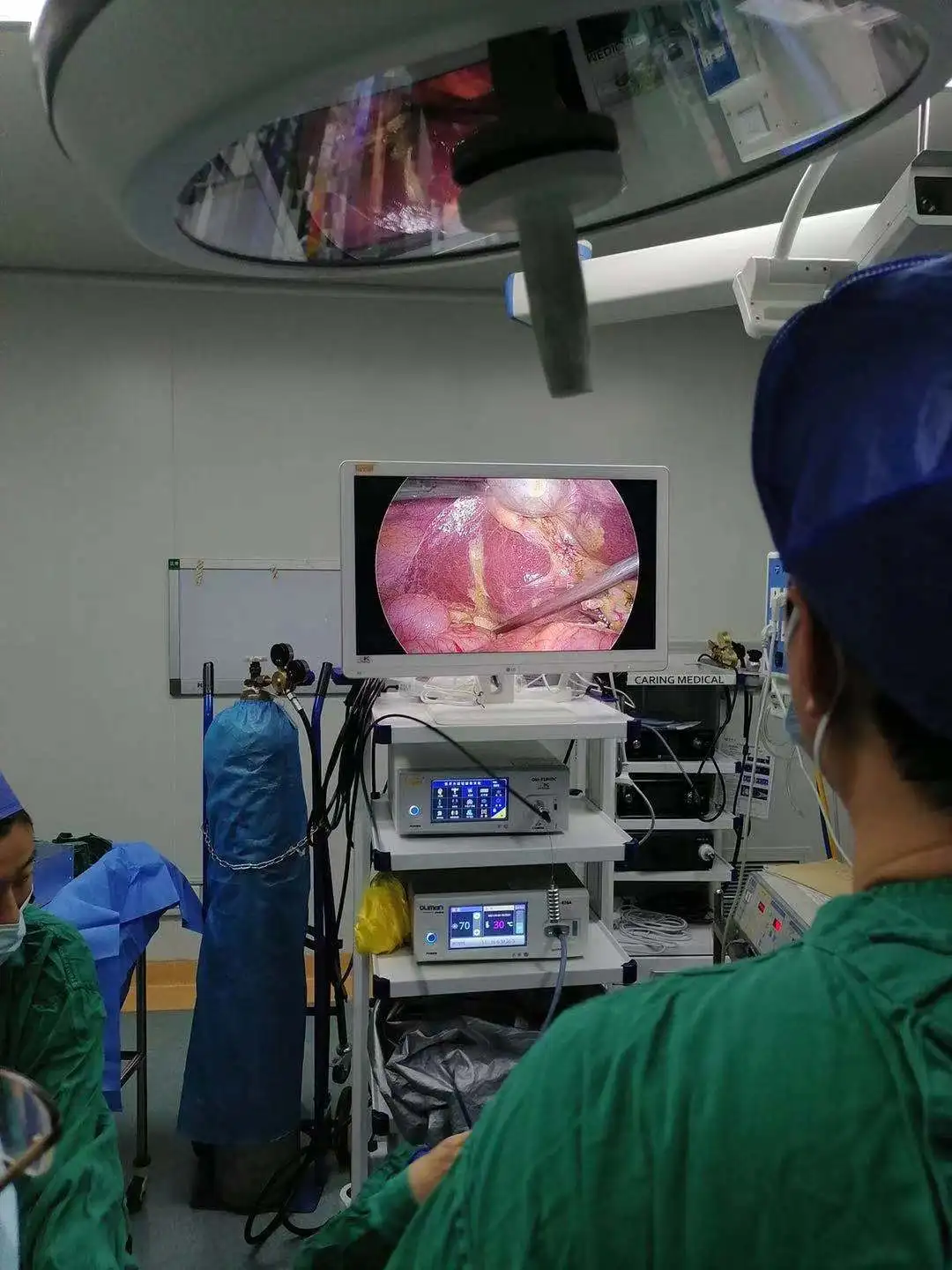 Medical 4K UHD 3810*2160P Endoscope Endoscopy Camera System Laparoscopic tower System