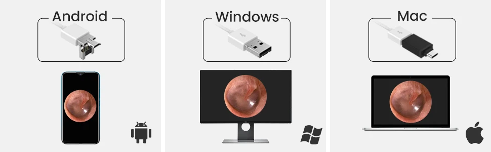 Endoscope Cheap and Fine Digital Otoscope with Camera Ear Household Portable Made in China Endoscope