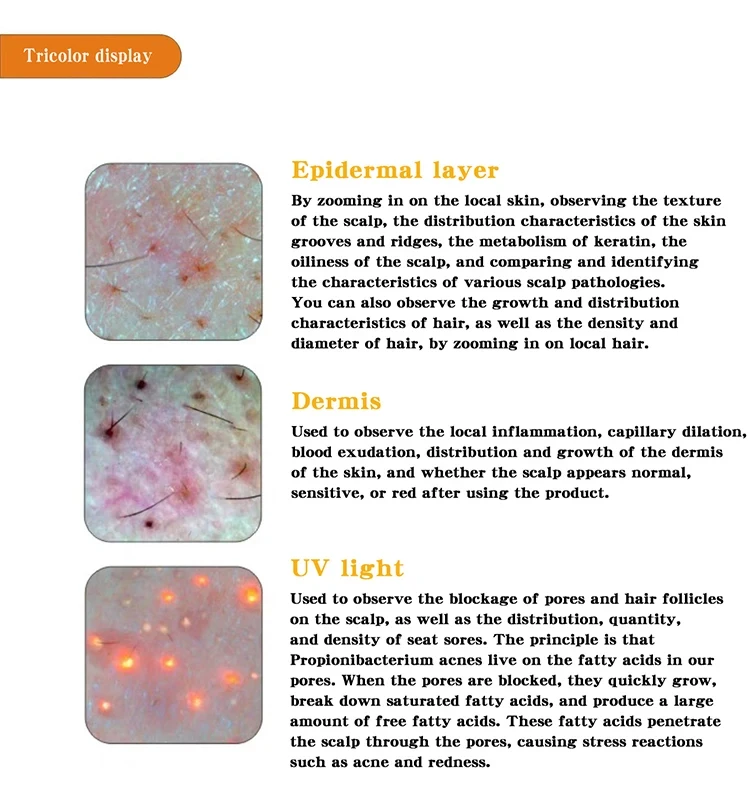 Hair follicles scalp scanner hair analysis functional equipment beauty equipment wholesalers