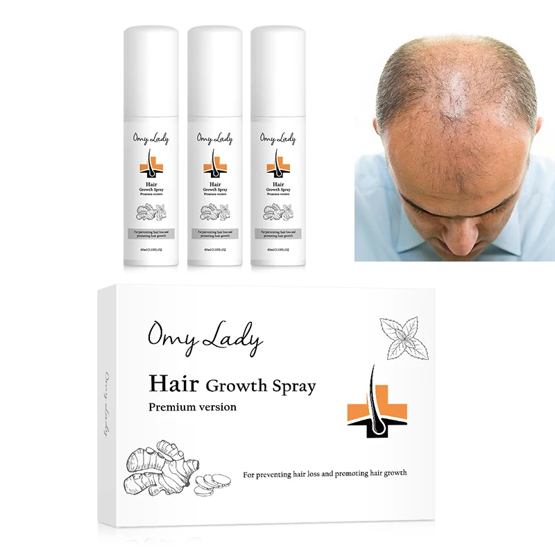 Best Selling OMY LADY Multi-Restorative Anti Balding Hair Growth Stimulator serum For All Hair Types