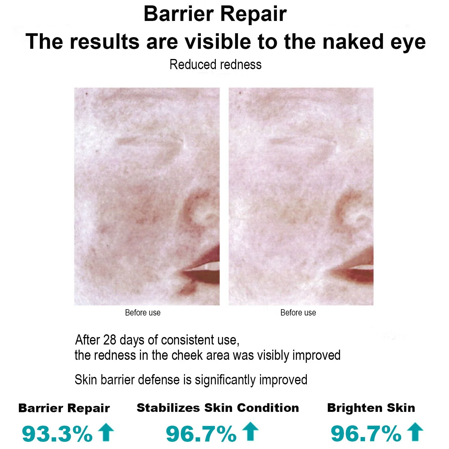 100% Natural Stretch Mark Remove Cream Scar Repair Cream Collagen Acne Scar Removal Cream Smooth Skin Scar Care
