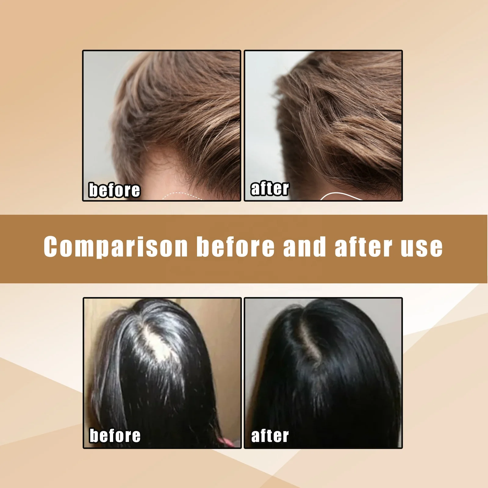 100% Natural Organic Ginger Hair Regrowth Shampoo Bar Anti Hair Loss Ginger Oil Control Hair Darkening Growth Shampoo Soap