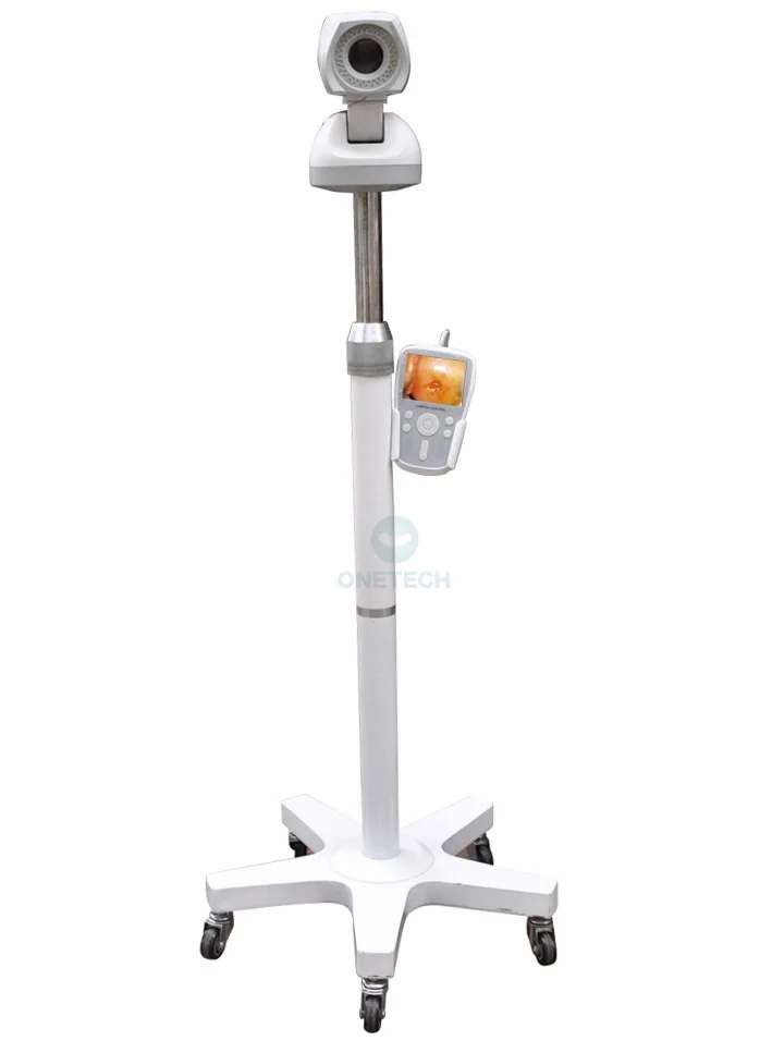 B42A Clearest Image Portable Electronic Colposcope color digital with CCD S ony Camera