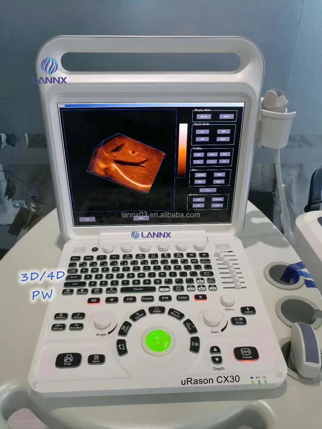 LANNX uRason CX30 New Arrival 3d/4d color doppler ultrasound ultrasonic Scanner Diagnostic System portable ultrasound machine