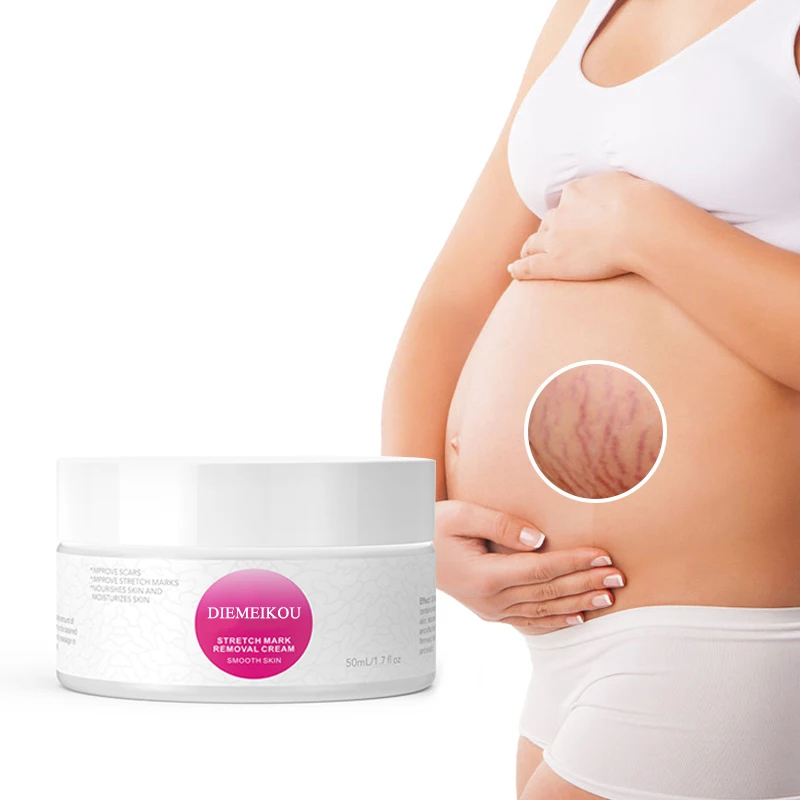 Powerful stretch mark removal Natural organic skin stretch repair Stretch mark removal cream