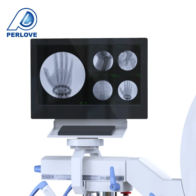 PLX116A Perlove Medical Hot sale portable Surgical  digital  C-arm x ray machine  for sale