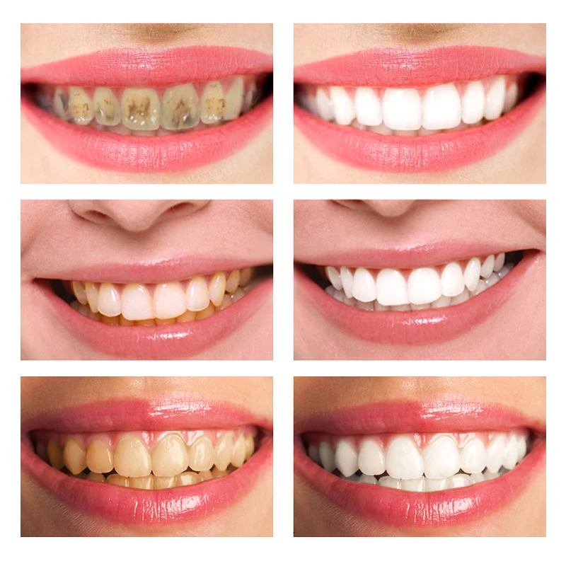 Spring tree Toothpaste Tooth Mousse Cleaning Paste White Private Logo Kit Label Cleansing Teeth Whitening Foam