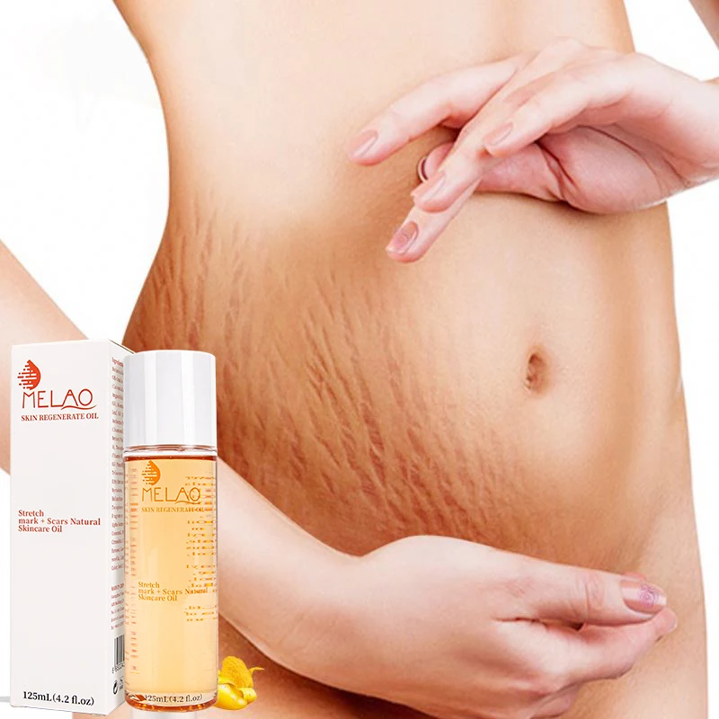OEM/ODM MELAO Wholesale Stretch Mark Oil Natural Organic Skincare Regenerate Oil Scar Repair Stretch Mark Removal Body Oil