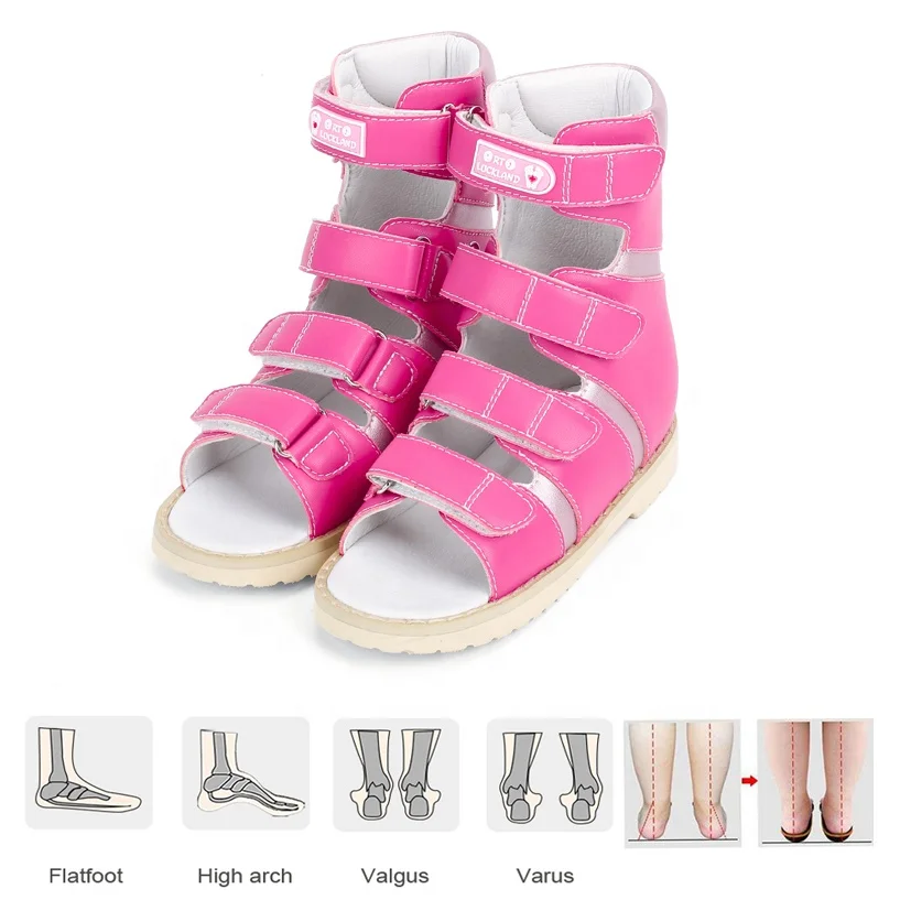 Children clubfoot flatfeet X/O Leg orthotic corrective shoes stylish kid girls summer footwear fancy sandals