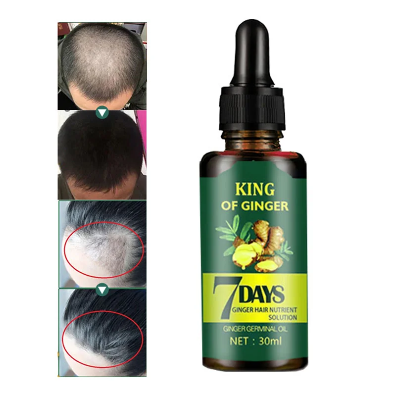 OEM&ODM Factory Best Hair Growth Oil For Baldness Scalp Repair Free Sample