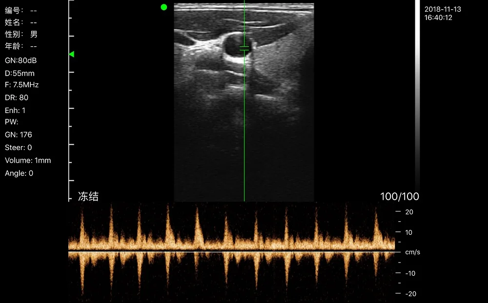 Konted gen4 pro medical ultrasound with linear probe for needle guide