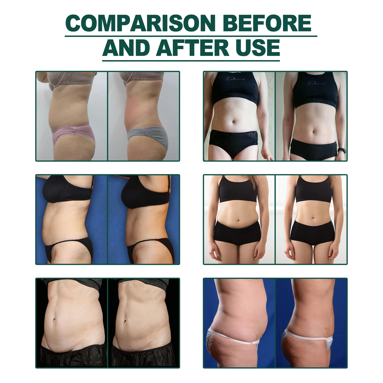 Hot Sale Purge and Shape Your Body Relaxing Bowel Poor Digestion Treating Natural Effective Ingredients Slimming Patch