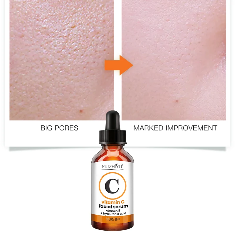 private label vitamin c serum face lifting facial essence skin care manufacturer face serum