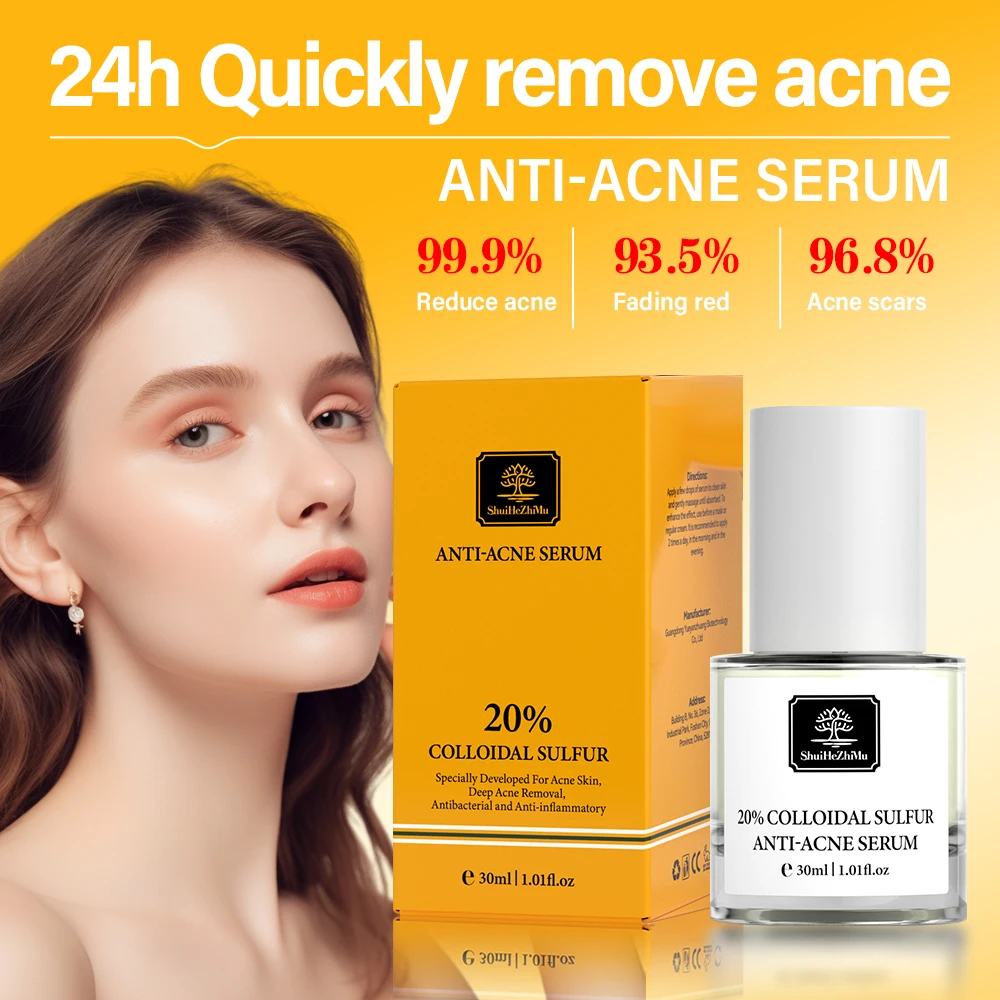 Colloidal Sulfur Anti-acne Serum For Acne Treatment Balancing Water Oil Improving Acne Scars Face Serum