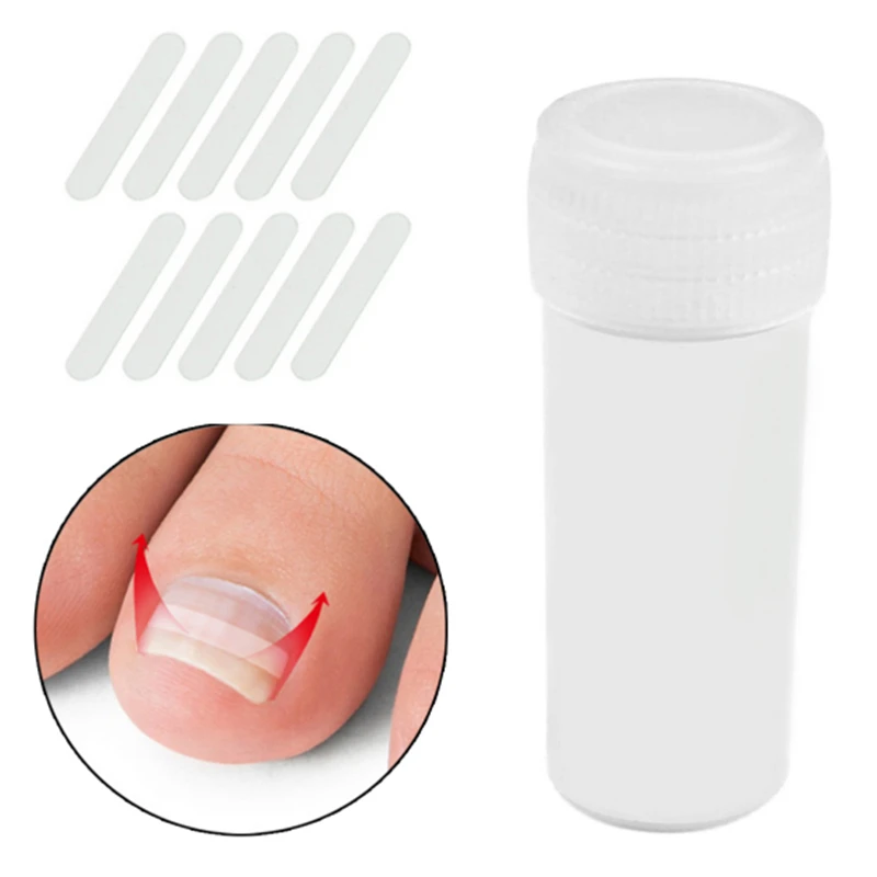 Ingrown Toe Nail Correction Paronychia Corrector File Sticker Patch Elastic Patch Corrector Foot Care Treatment Pedicure