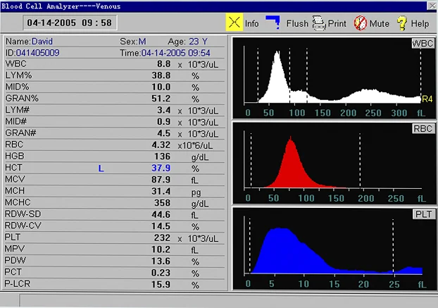 Sinothinker Touch Screen Open System Blood Automated Veterinary Hematology Analyzer Online Technical Support Class Ii