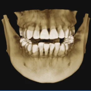 HiRes3D-Plus  Digital Professional x-ray dental  CT with   3D face scan
