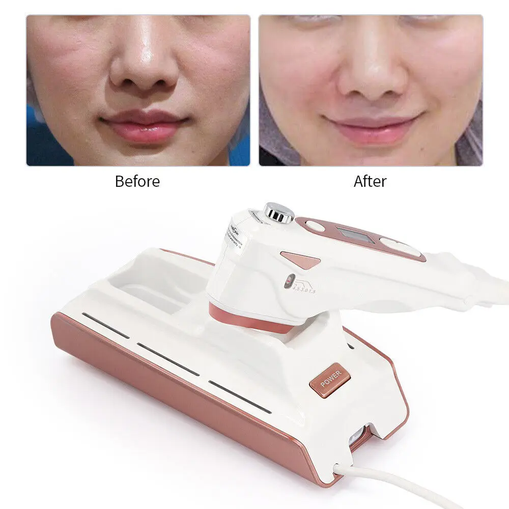 Portable Helloskin Beauty Facial Massager Face Lifting Device Skin Tightening Machine for Spa Salon and Home Use
