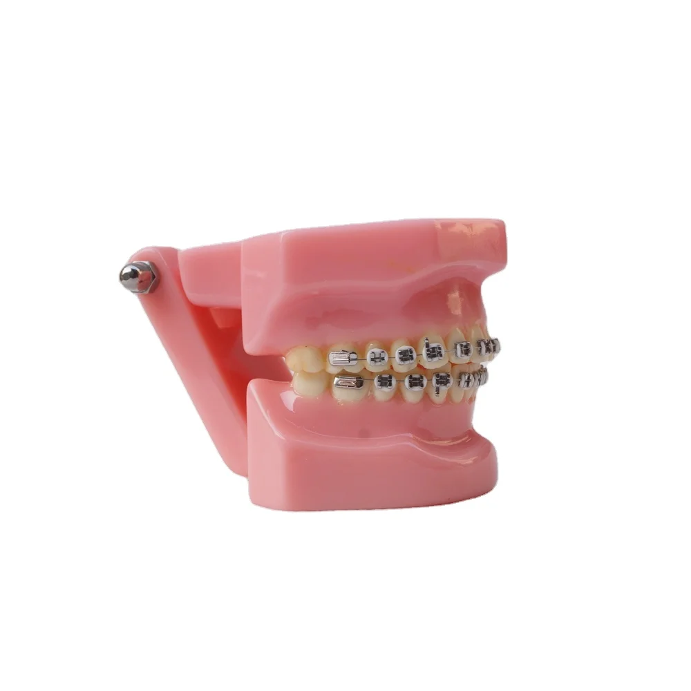 Стоматологическая Ортодонтическая модель для изучения зубов с металлическим кронштейном