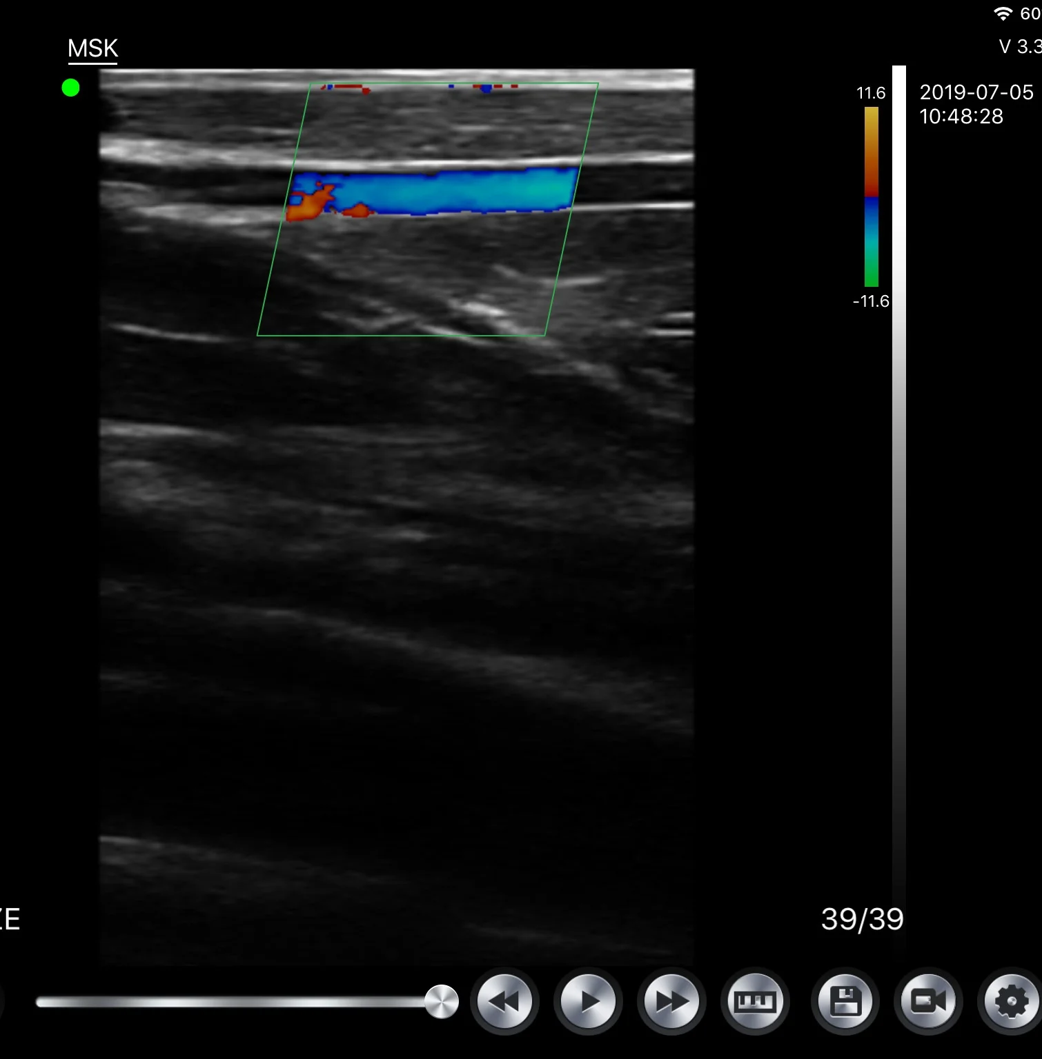 
Mini konted c10cx vascular color doppler ultrasound machine probe for pregnancy 