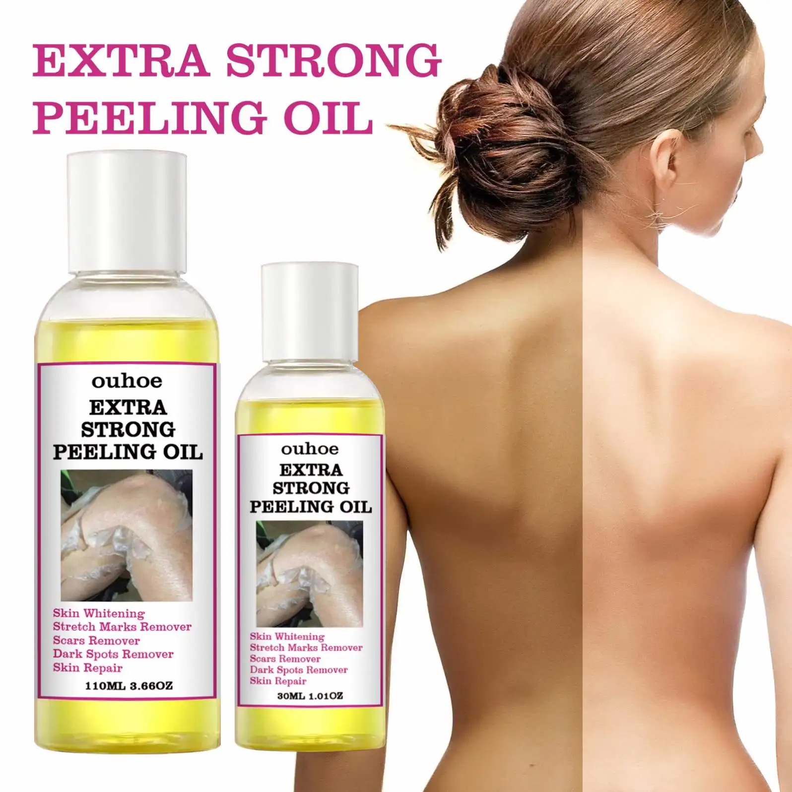 Private label Extra Strength Yellow Peeling Oil Elbows Knees Hands Melanin Bleaching Dark Skin Knuckle Whitening Removal Oil