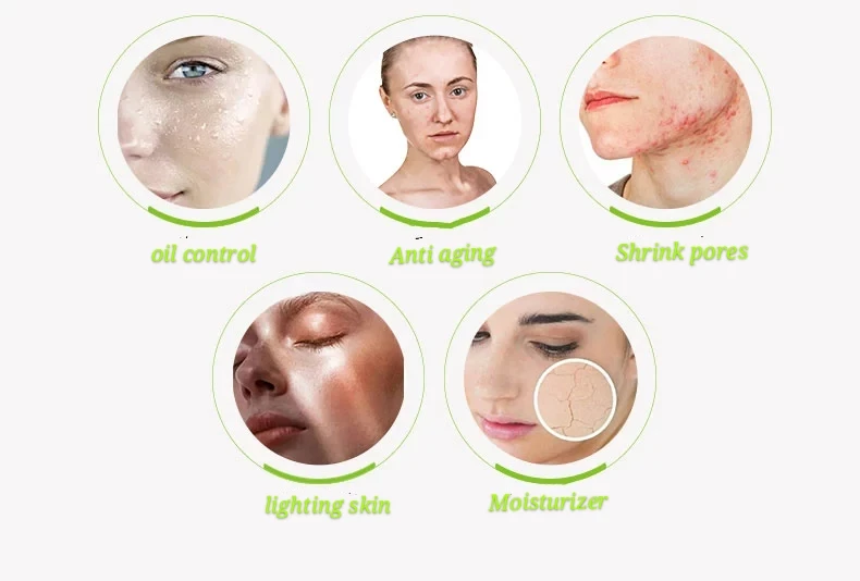 No label handmade organic moisturizer acne melasma melt and pour soap base goat milk