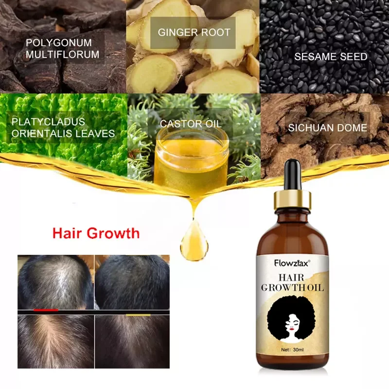 Natural Organic Private Label Vegan Treatment for Baldness Hair Growth Essential Oil Herbal Anti-Hair Loss Hair Growth Oil