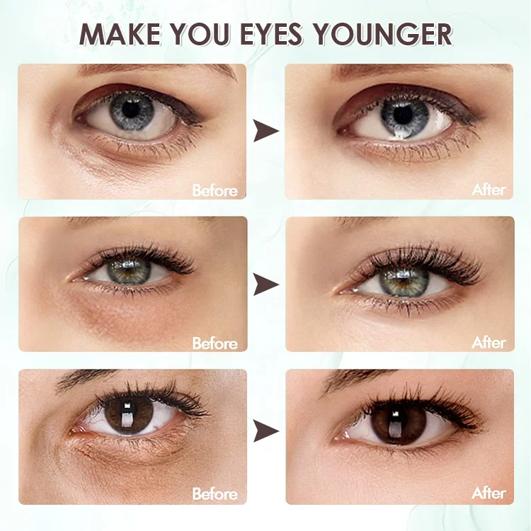 
Low Price OEM Wholesale Factory Remove Fine Lines Fade Dark Circles Tighten Crystal Gel Seaweed Eye Masks 