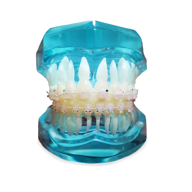 Orthodontic Dental Clear Self-ligating Brackets Teeth Model With Sapphire Self-Ligating Orthodontic Braces