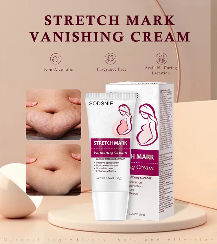 New Arrival Skin Care Pregnancy Slack Anti Stretchmark Scar Repair Body Stretch Marks Removal Cream for Selling