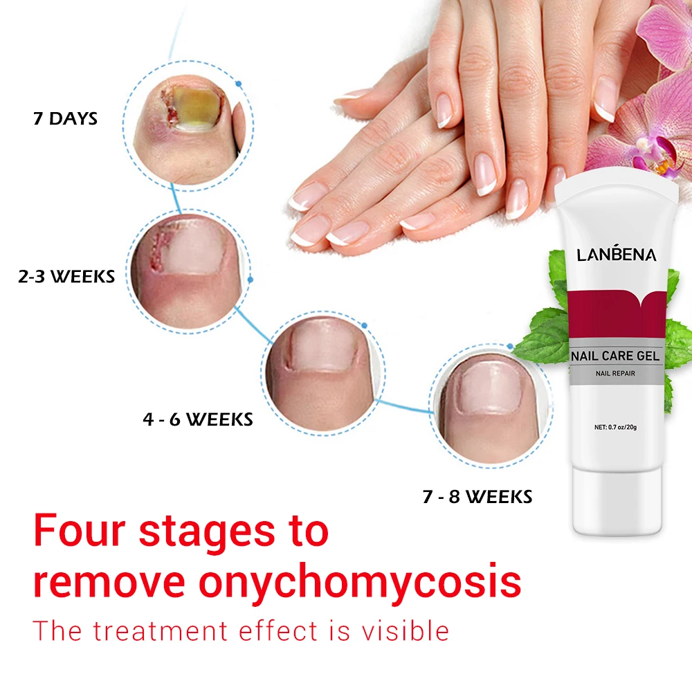 LANBENA Foot Nail Fungus Treatment Essence Nail Repair Gel Fungus Onychomycosis Treatment with Nail File gift