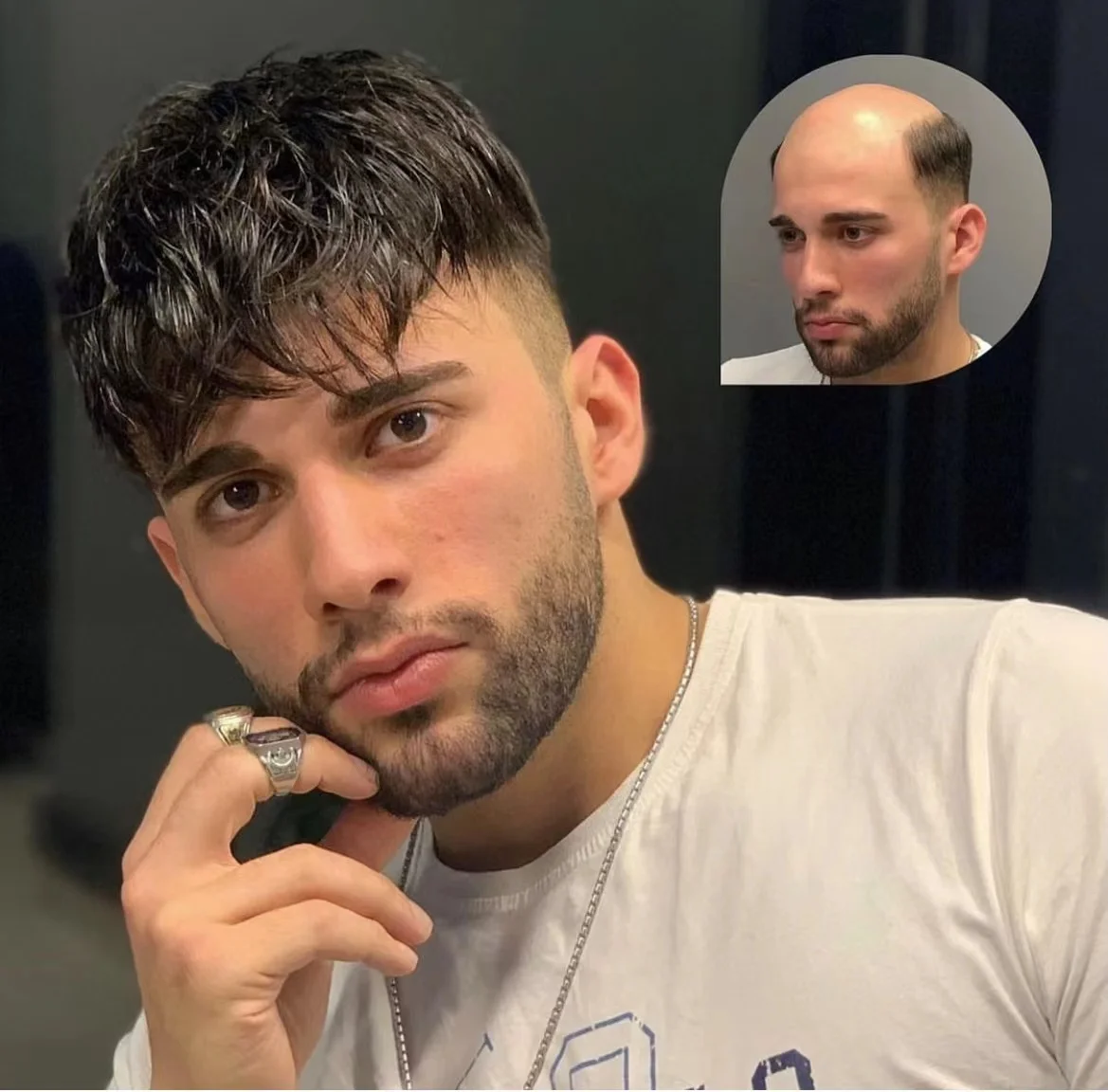 Lace & PU Toupee Replacement Handmade Men Toupee Hairpiece Natural Remy Indian Human Hair Black Toupee