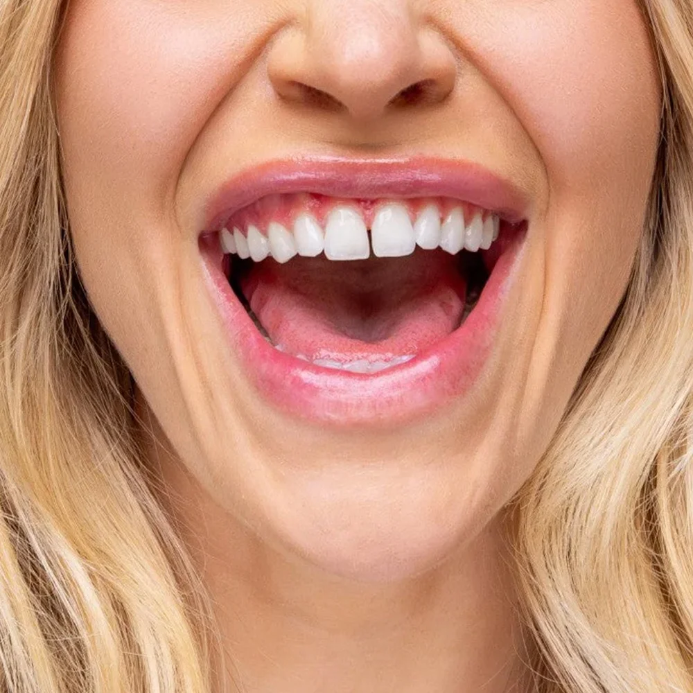 Customized  25pcs  Teeth Whitening chewable Toothpaste Tablets