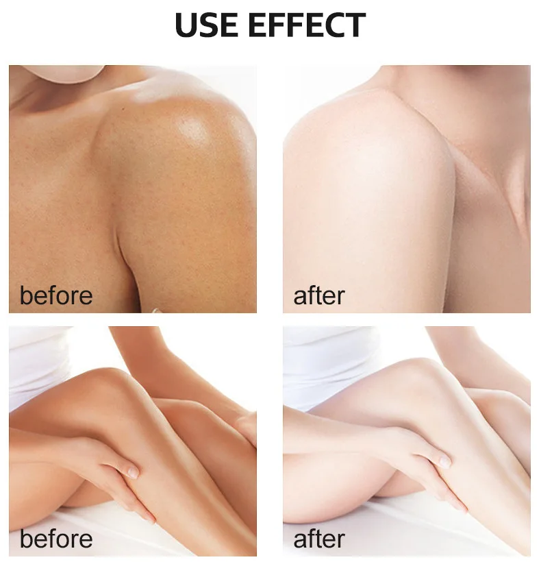 Skin Care Cosmetics Beauty Products Most Effective Super Strong Body Whitening Exfoliator Skincare Lotion Yellow Peeling Oil