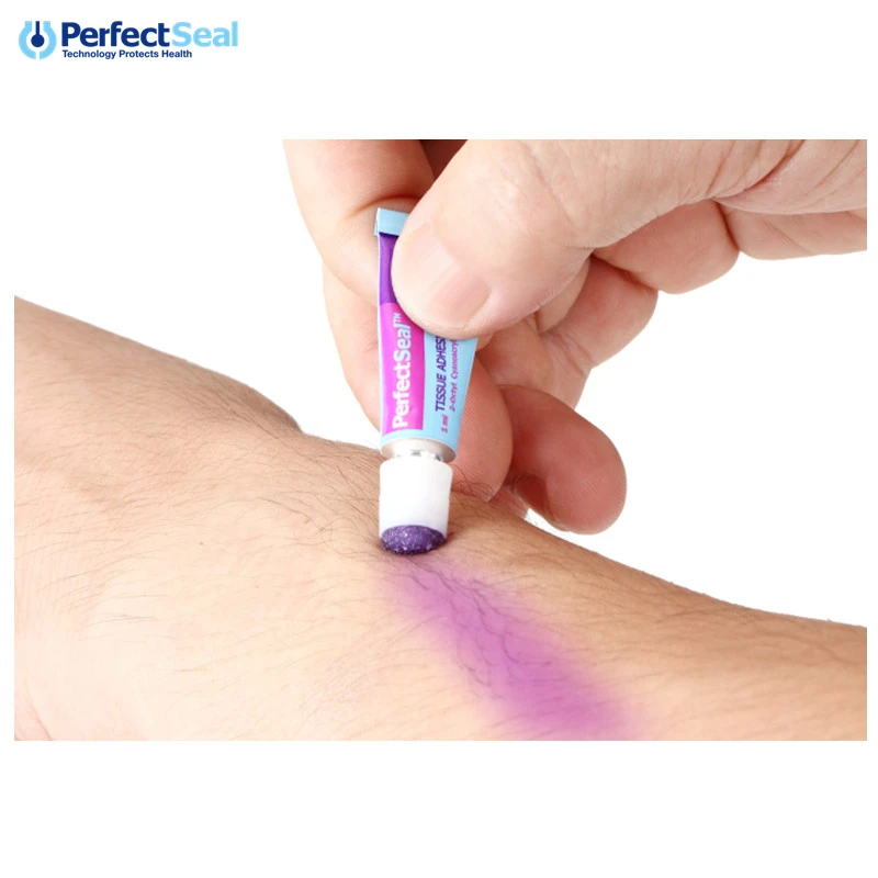 0.5ml 2-Octyl Cyanoacrylate Blue Tissue Adhesive Skin Glue For Wound Repair