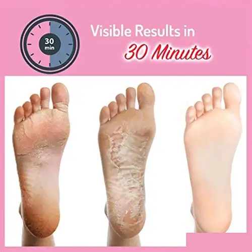 Private Label OEM Magic Purederm Braphy Callus Remover Pack Exfoliating Baby Foot Peeling Mask foot soak