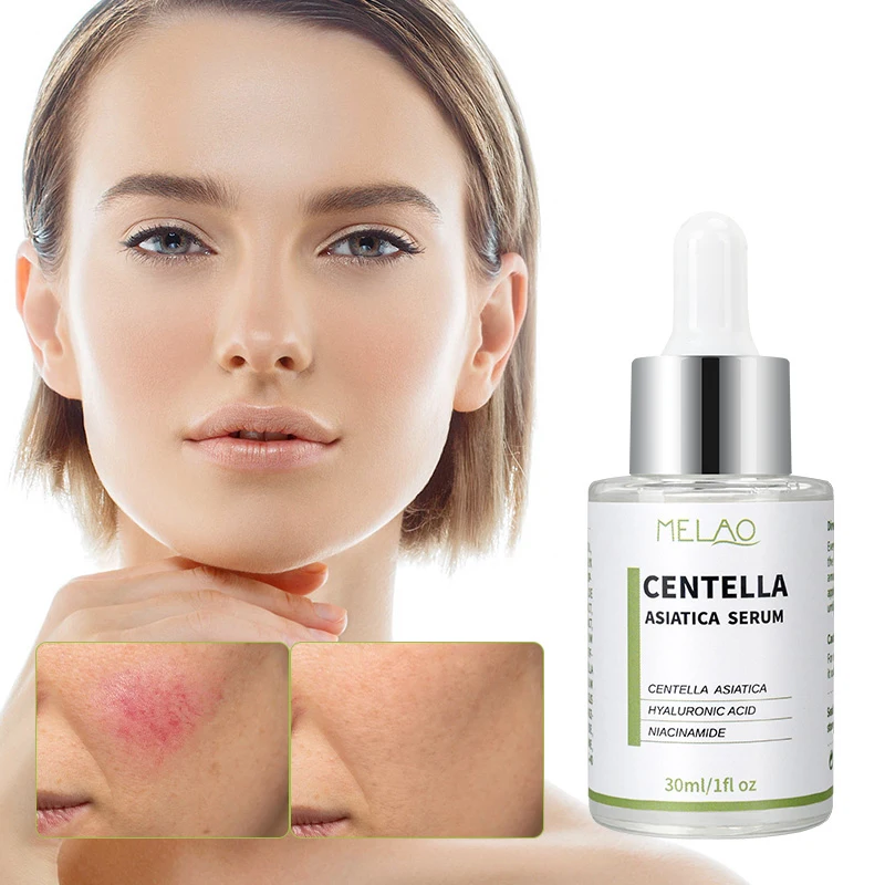 Custom Logo Rapid Soothing Skin Repair Oil Skin Face Serum Sebum Rebalancing Rx 131 Ampoule Minimize Sebum Serum