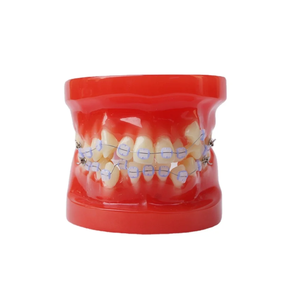 Dental Typodont Model Study Teeth Model With Ceramic Bracket