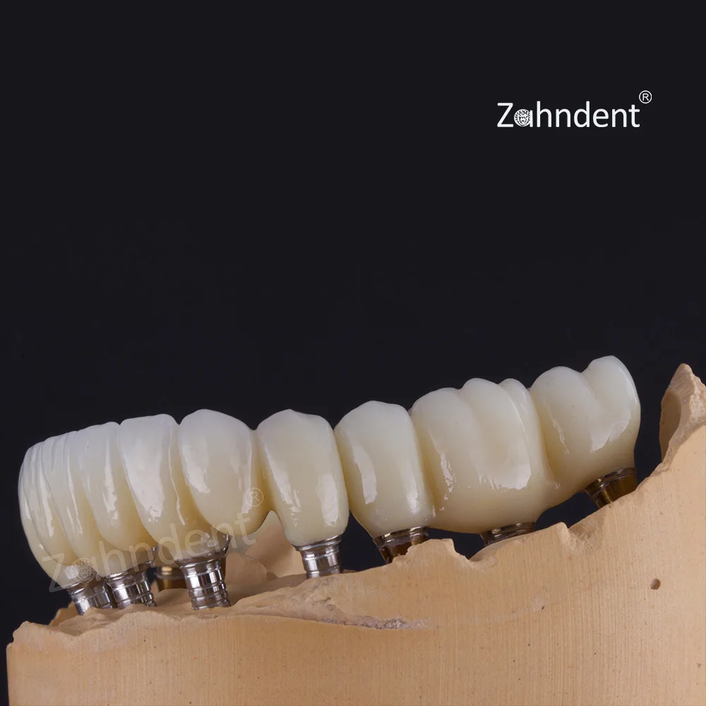 Zahndent high cost-effective 40% translucency dental zirconia block teeth restoration