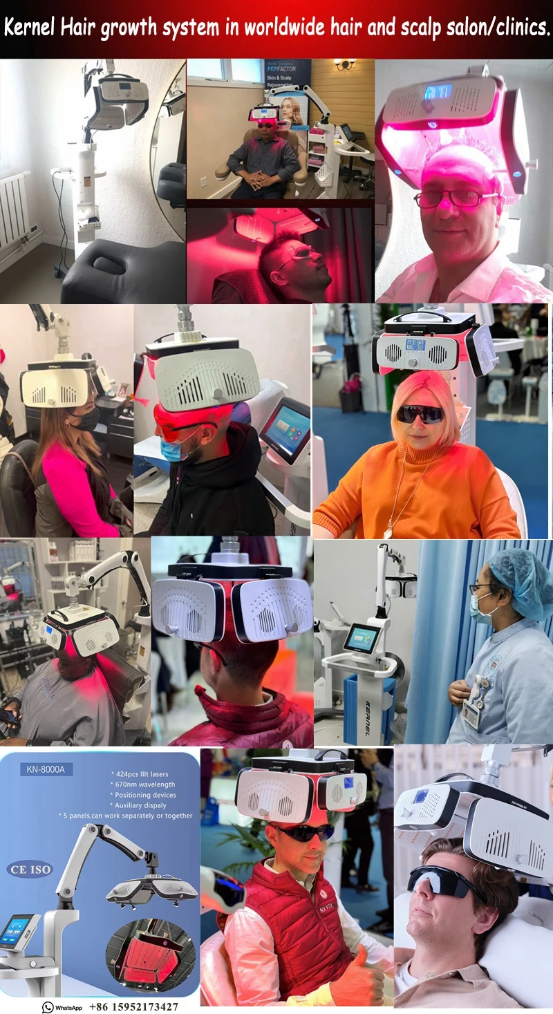 Kernel PRP (Platelet-Rich Plasma) Laser Diodes Therapy Procedure Hair Loss Treatment Baldness Alopecia KN-8000A