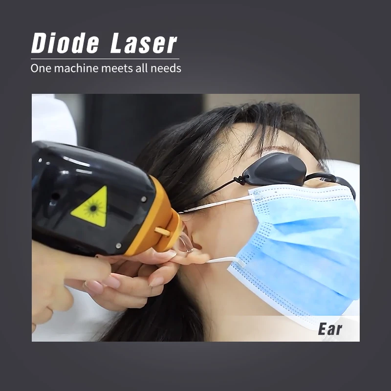 Medical CE approved Hottest Machine Device 808 Diode Laser Hair Removal for spa