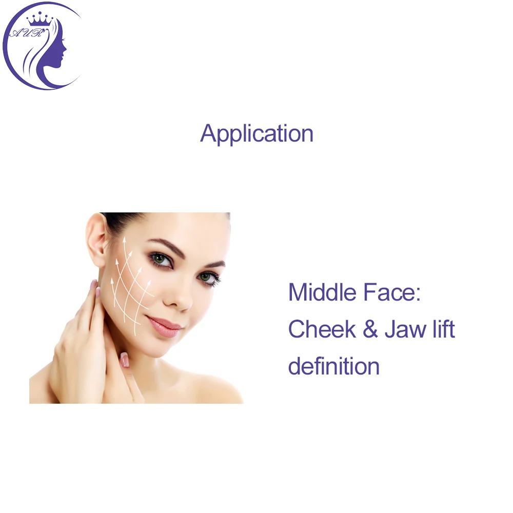 Skin Care Disposable Cones cog 18G 100mm pdo thread lift molding thread de hilo cannula needle for face