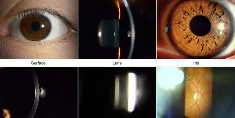 Professional SLM-3ER with Highest Quality Best Price Digital Slit Lamp Ophthalmic equipment ophthmology instrument