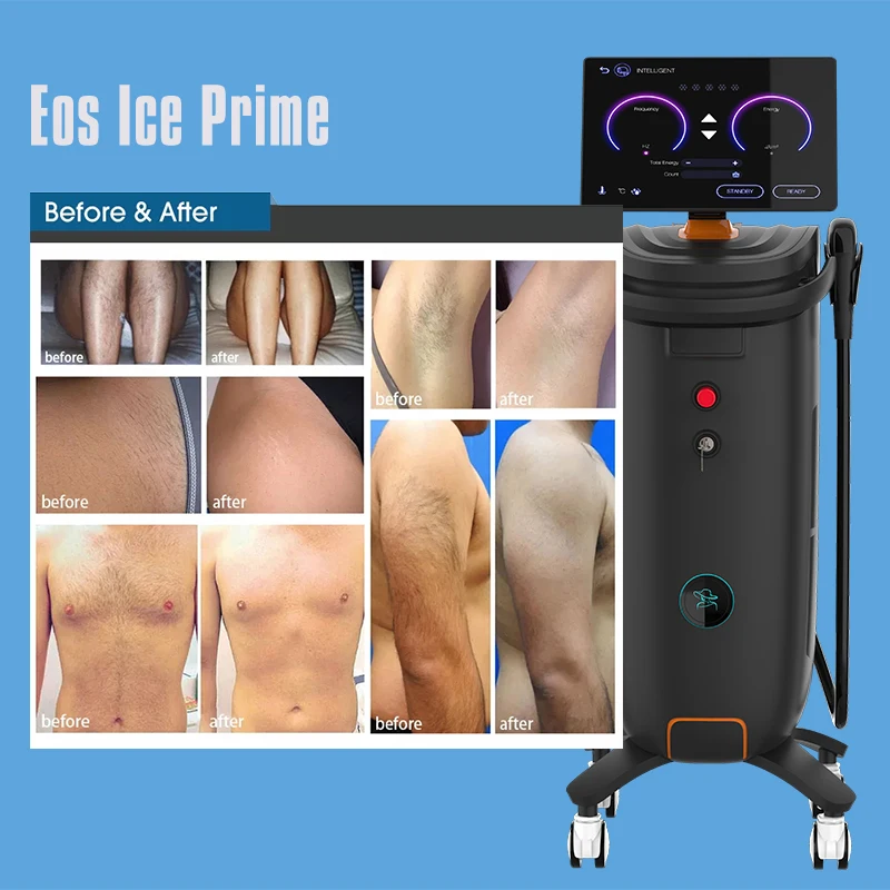 Pz Laser Diode Laser Hair Removal Machine Permanent Big Power Fiber Diodo 808 Laser Hair Removal Machine Price