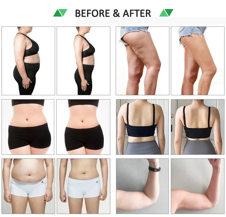 2023 New Design 10d Maxlipo Master Laser Xm-68 10d Maxlipo Laser 10d For Weight Loss