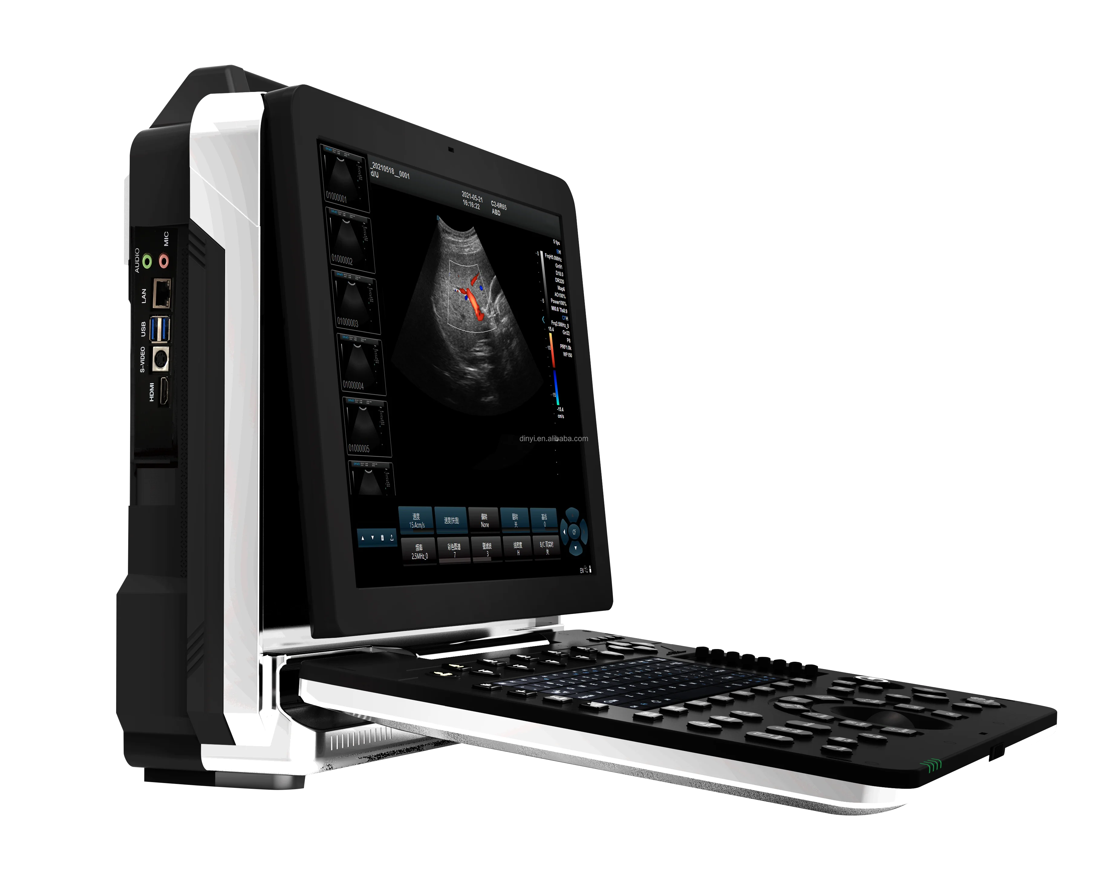 CE ISO сертифицированный OEM Заводская цена портативный полноцветный допплер ультразвуковой аппарат сканер 3/4/5D диагностическая система
