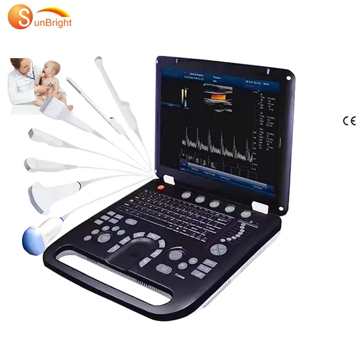 SUN-906C 3D 4D PW CW Portatil Full Digital 192 elements Color Doppler Fetal Pregnancy Ultrasonic Diagnostic Ultrasound Machine